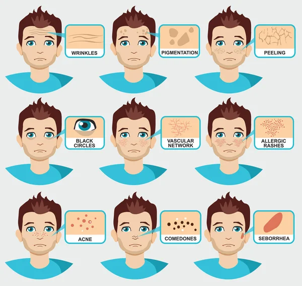 Man Skin Problems Vector Illustration Male Face Pimples Dark Spots — Stock Vector