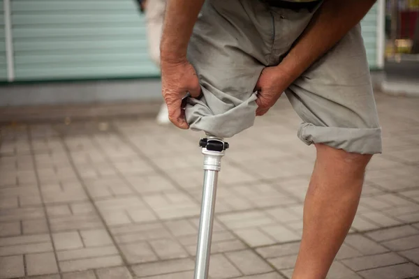 Металлическая протезная нога. Простые протезы для мужской ноги. — стоковое фото