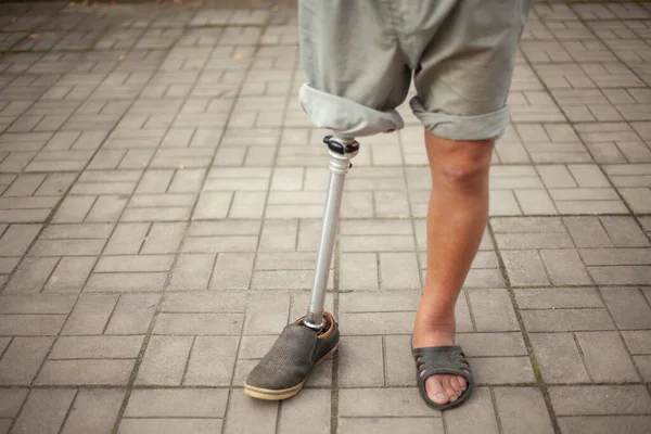 Perna protética metálica. Próteses simples para a perna de um homem. — Fotografia de Stock