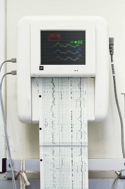Bebeğin kalp atışlarını, elektrokardiyografisini ve doğum ve doğum odasındaki ana rahmini kapatın..