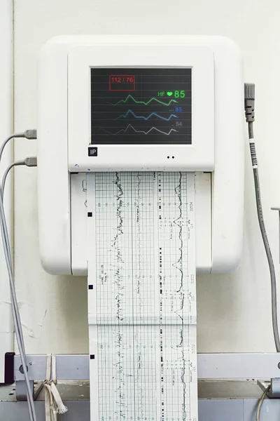 Primer Plano Monitor Fetal Prueba Esfuerzo Que Imprime Latidos Cardíacos — Foto de Stock