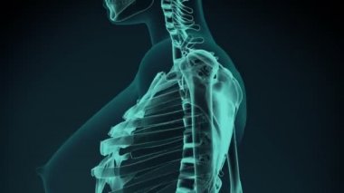 Omuz ağrılı 3d İllüstrasyon, tıbbi kavram animasyon.