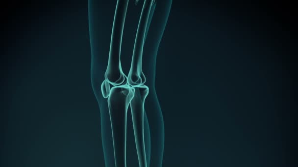 膝の痛みのアニメーション 変形性関節症を伴う健康な関節と不健康な痛みを伴う関節 — ストック動画