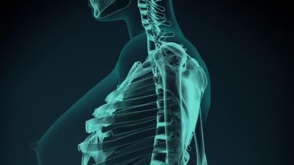 肩部疼痛插图 医学概念动画 — 图库视频影像