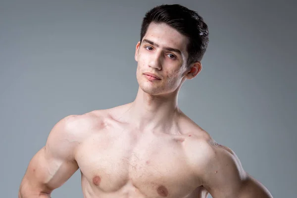 Retrato de estúdio de um jovem morena caucasiano em fundo cinza posando. Tema da puberdade, pele do problema, acne adolescente — Fotografia de Stock