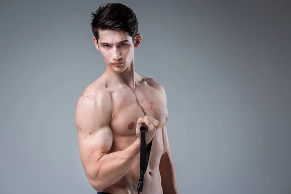Studio portrait young Caucasian man on gray background posing. theme of puberty, problem skin, teen acne. Caucasian athlete uses banding for fitness. Allergy sports nutrition, supplements steroids — Φωτογραφία Αρχείου
