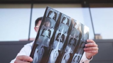Doktor göğüs ve karın tomografisini inceliyor. Pulmonoloji, akciğer patolojisi, bronşların iltihaplı hastalıkları, tüberküloz, covid 19 veya koronovirüs hastalıklarının teşhisi için röntgen veya MRI.
