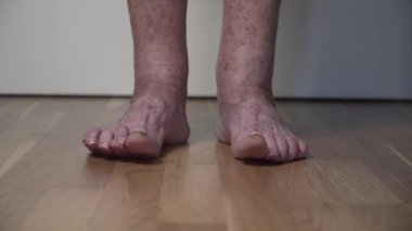 Yaşlı hasta bacak. Kıdemli bacak sorunları. Tırnakları sakat, yaşlı bir kadın. Yaşlı kadın parmaklarında ayak mantarı var. Yaklaşın. Dağınık kocakarı tırnakları. Bacaklardaki nasırlar ve yaralar. Acı ve rahatsız ayaklar