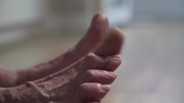 Yaşlı hasta bacak. Kıdemli bacak sorunları. Tırnakları sakat, yaşlı bir kadın. Yaşlı kadın parmaklarında ayak mantarı var. Yaklaşın. Dağınık kocakarı tırnakları. Bacaklardaki nasırlar ve yaralar. Acı ve rahatsız ayaklar