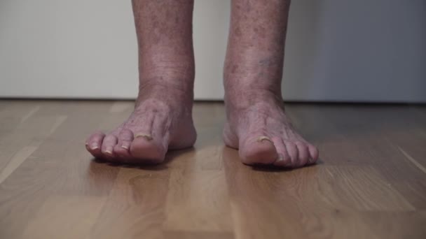 Jambe âgée malade. Problèmes de jambe senior. Jambes vieille femme avec des ongles handicapés. Le champignon de l'ongle du pied sur les orteils femelles âgées se referme. Oublie les ongles d'orteils. Des callosités et des plaies aux jambes. Douleur et gêne pieds — Video