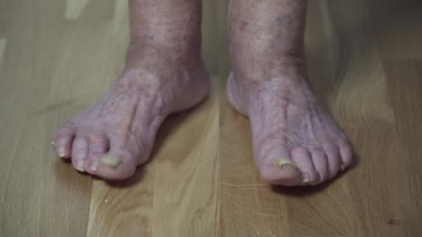 Detailní záběr starých nemocných ženských nohou se zkřivenými prsty a dlouhými děsivými nehty. Starší žena je nahá s bolavýma nohama. Velké velmi staré nohy důchodce neostříhané žluté hrozné nehty — Stock video