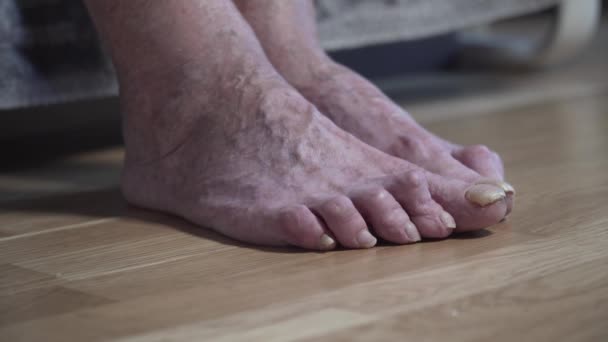 Unghie dei piedi doloranti primo piano persona irriconoscibile, vecchio. Una povera donna piedi umani sembrano spaventosi e orribili con lunghi, unghie non tagliate. Rughe gambe macchiettate anziana femmina — Video Stock