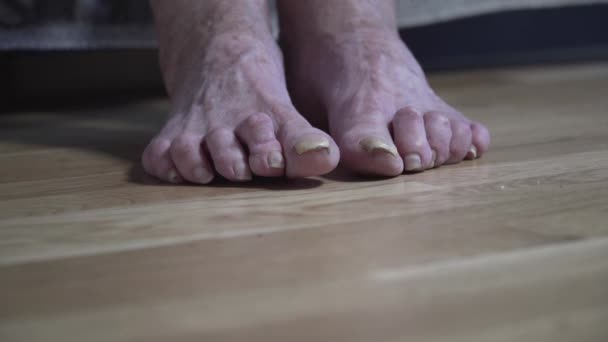 病気の高齢者の足。上肢の問題だ。足の爪の老婦人。年配の女性のつま先の毛の真菌が閉じます。核兵器のないクローンの爪だ。足の爪や痛み。痛みと不快感の足 — ストック動画