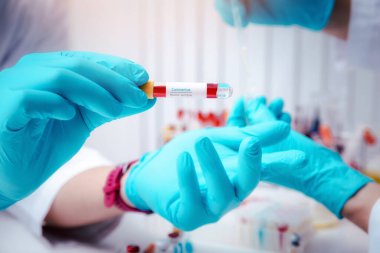 Araştırmacılar kan örneklerini laboratuvarda test ediyorlar. Araştırmacılar COVID-19 virüsünü tedavi etmek için aşı icat ediyorlar..