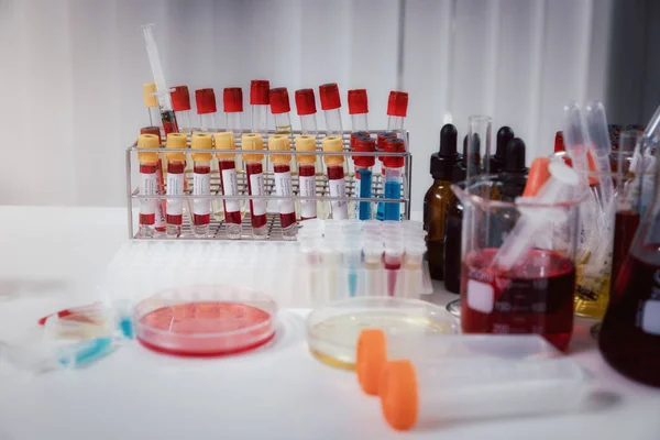 Muestras Sangre Tubos Jeringas Mesa Trabajo Laboratorio Examen Médico —  Fotos de Stock