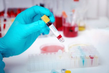 Araştırmacılar kan örneklerini laboratuvarda test ediyorlar. Araştırmacılar COVID-19 virüsünü tedavi etmek için aşı icat ediyorlar..