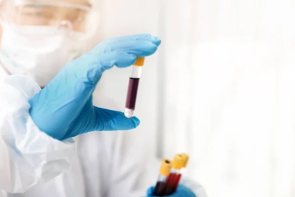 Los Investigadores Analizan Muestras Sangre Laboratorio Los Investigadores Están Inventando — Foto de Stock