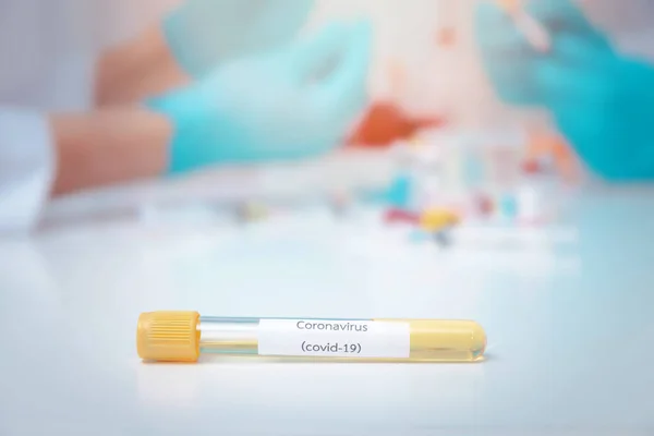 코로나 바이러스 Coronavirus Covid 혈액에서 플라스마가 포함된 시험관 의약품이나 백신을 — 스톡 사진