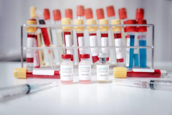 医療研究室の作業台におけるコロナウイルスワクチン Covid のサンプル — ストック写真