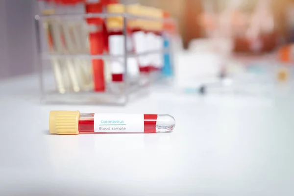 Vzorky Krve Zkumavkách Pracovním Stole Laboratoři Pro Lékařské Vyšetření — Stock fotografie