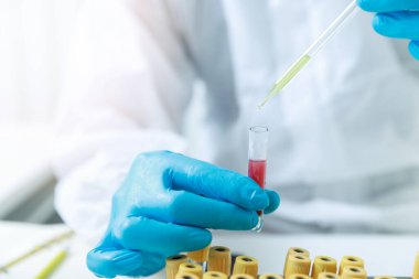 Araştırmacılar kan örneklerini laboratuvarda test ediyorlar. Araştırmacılar COVID-19 virüsünü tedavi etmek için aşı icat ediyorlar..