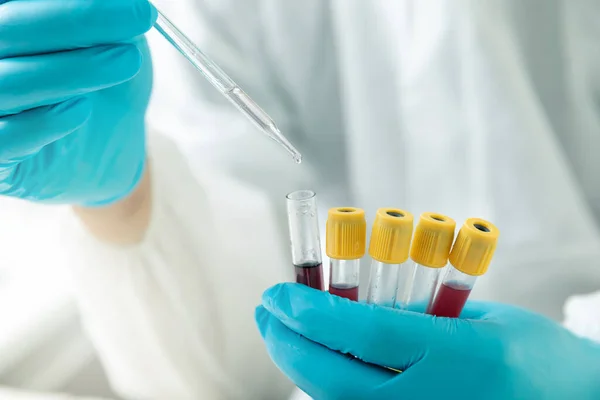 Ερευνητές Εξετάζουν Δείγματα Αίματος Και Πλάσματος Στο Εργαστήριο Ερευνητές Εφευρίσκουν — Φωτογραφία Αρχείου