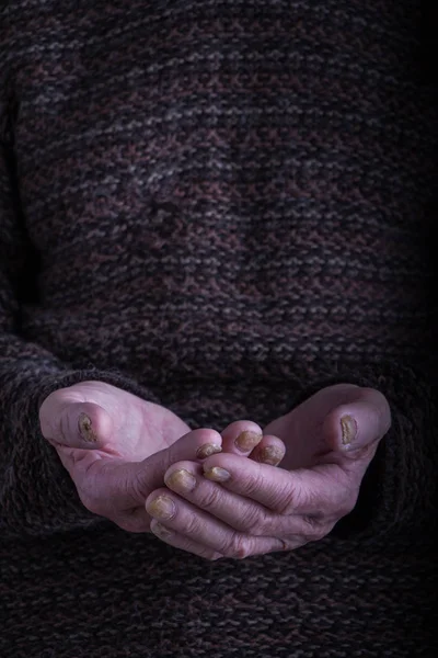 Dłonie starej osoby w ciemnym, szorstkim swetrze są składane razem, pojęcie pomocy, opieki i zdrowia, tła lub koncepcji — Zdjęcie stockowe