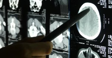 Doktorlar kafa kafatası beyin röntgen filmi analysis.health tıbbi hastane için çalışma.