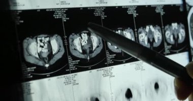Doktorlar kafa kafatası beyin röntgen filmi analysis.health tıbbi hastane için çalışma.