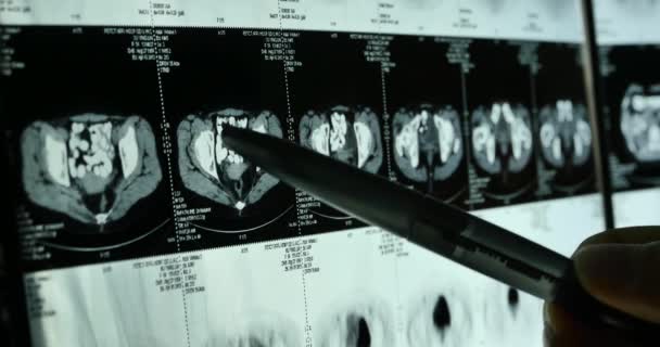 4k Los médicos estudian la radiografía del cerebro del cráneo para el hospital médico analysis.health . — Vídeo de stock