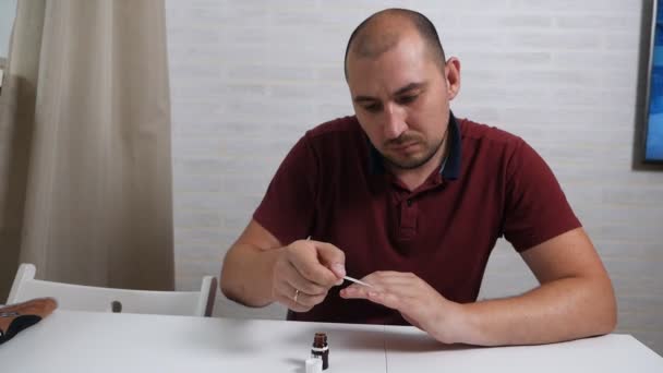 Un hombre calvo respetable trata sus uñas con una droga especial para curar el hongo. Tratamiento de hongos en la mano en casa — Vídeos de Stock