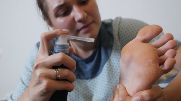 Houba na chodidle Koncepce dermatologie, léčba plísňových infekcí a pásového oparu — Stock video