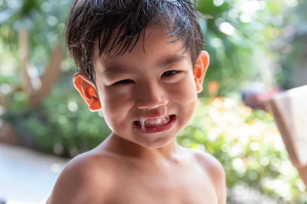 Uzavřít Hlen Teče Nosu Asijské Boy Rýma Jasnou Nudle — Stock fotografie