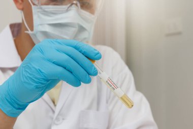 Research and development concept, Laboratory scientist researching covid-19(corona virus) vaccine at laboratory.