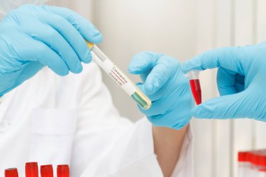 Research and development concept, Laboratory scientist researching covid-19(corona virus) vaccine at laboratory.