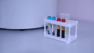 Kişi laboratuvarda plastik raftan test tüpleri alır, eller closeup.