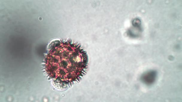 Egy igazi vörös sejt, mint egy tüskés koronavírus mikroszkóp alatt. — Stock videók