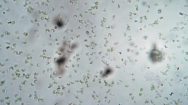 Ciliate vorticella livnär sig på bakterier i oroliga vatten — Stockvideo