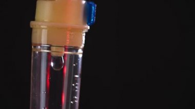 Sıvı damlaları makrodaki infüzyon makinesinin içine düşüyor.