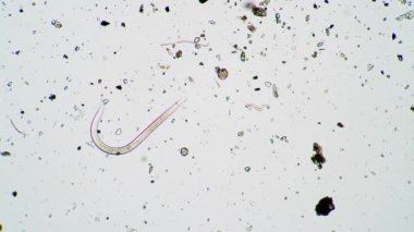 Küçük nematode mikroskop altında yosun suyunda hareket ediyor.