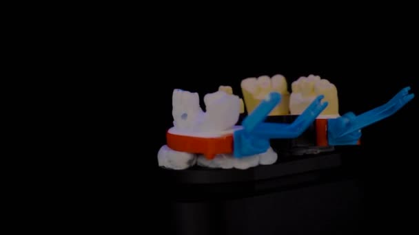 Närbild: 3D dentalskanner för dentalgipsmodellering och mätning — Stockvideo