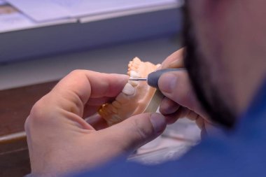 Diş teknisyeni diş protezleriyle çalışıyor. Görüntüyü kapat.