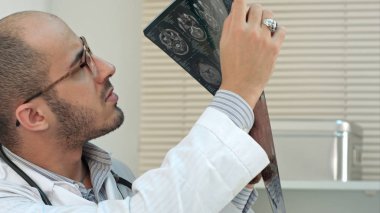Tıbbi alt beyin analiz bilgisayarlı tomografi x-ray görüntü