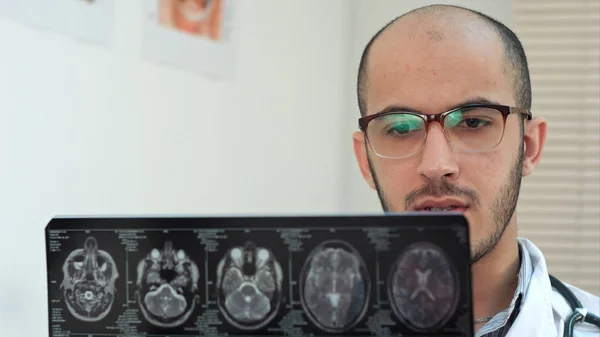 Male radiologist examining brain computed tomography — Stock Photo, Image