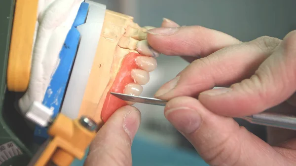 Laboratóriumi technikus fogászati implantátum egyenetlenségek eltávolítása — Stock Fotó