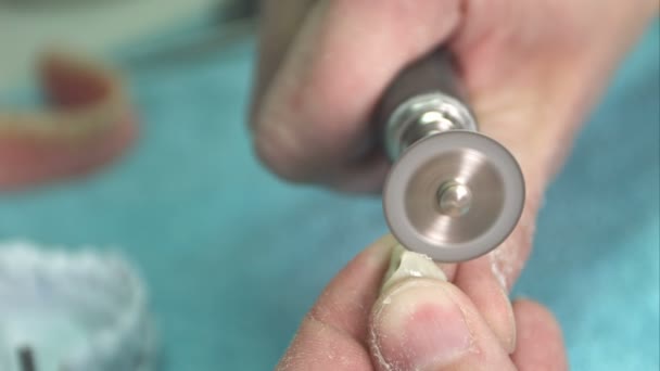 Техник в стоматологической лаборатории по изготовлению протеза — стоковое видео