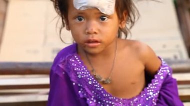 Siam Reap, Kamboçya - 14 Ocak 2017: Paçavra küçük bir evsiz kız portresi. Kamboçya'da yoksulluk