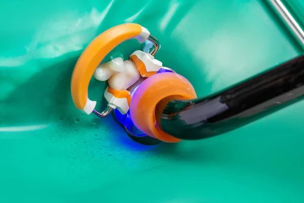 Фотокомпозитна Лампа Зубні Інструменти Лікування Зубів Крупним Планом — стокове фото