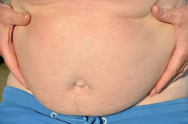 Fat belly of a man.