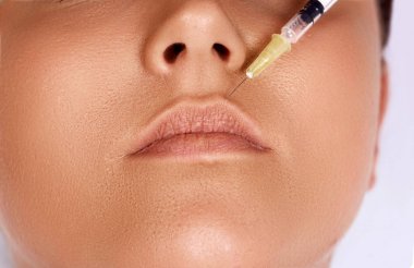 Dudak Büyütme Prosedürünün Yakın Çekim. Hyaluronik Asit Enjeksiyonalan Güzel Genç Kadın Ağız. Seksi Kadın Dudaklar. Kozmetoloji Tedavisi